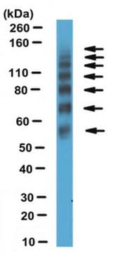 Anti-CEA cell adhesion molecule 16 (Ceacam16) Antibody from rabbit, purified by affinity chromatography