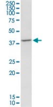 Monoclonal Anti-TFB1M antibody produced in mouse clone 4E4, purified immunoglobulin, buffered aqueous solution