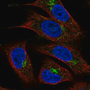 Anti-TMEM5 antibody produced in rabbit Prestige Antibodies&#174; Powered by Atlas Antibodies, affinity isolated antibody