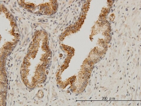 Monoclonal Anti-AAAS antibody produced in mouse clone 5A1, purified immunoglobulin, buffered aqueous solution