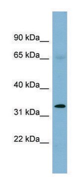 Anti-HEY1 antibody produced in rabbit affinity isolated antibody