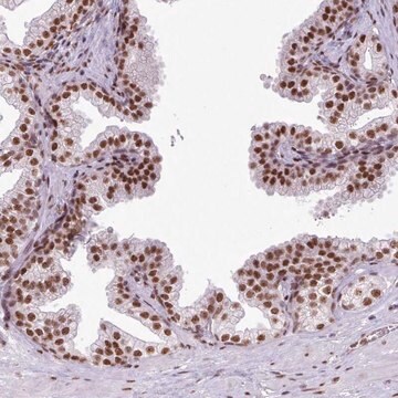 Anti-FAM182B antibody produced in rabbit Prestige Antibodies&#174; Powered by Atlas Antibodies, affinity isolated antibody, buffered aqueous glycerol solution