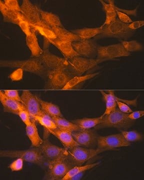 Anti-tPA/PLAT antibody produced in rabbit