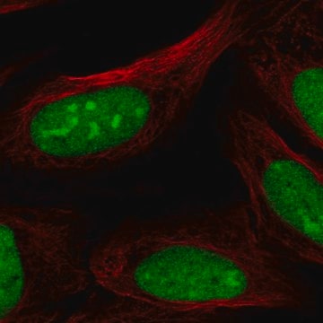 Anti-CRISPLD2 antibody produced in rabbit Prestige Antibodies&#174; Powered by Atlas Antibodies, affinity isolated antibody