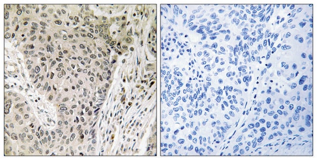 Anti-ARHGEF19 antibody produced in rabbit affinity isolated antibody