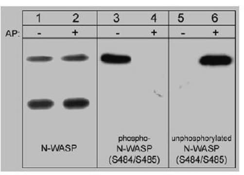 Anti-N-WASP Antibody, phospho-specific [Ser484/Ser485] Chemicon&#174;, from rabbit