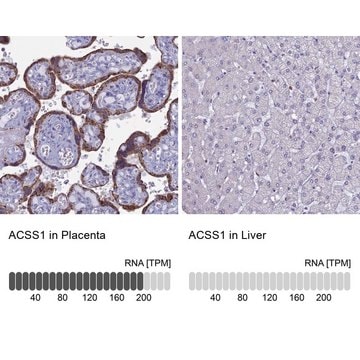 Anti-ACSS1 antibody produced in rabbit Prestige Antibodies&#174; Powered by Atlas Antibodies, affinity isolated antibody, buffered aqueous glycerol solution