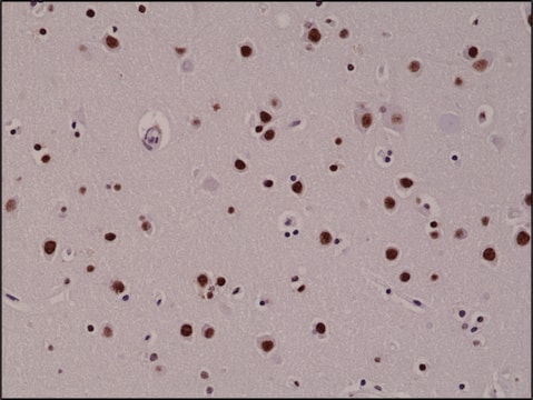 Anti-5-Hydroxymethylcytosine antibody, Rabbit monoclonal recombinant, expressed in HEK 293 cells, clone RM236, purified immunoglobulin