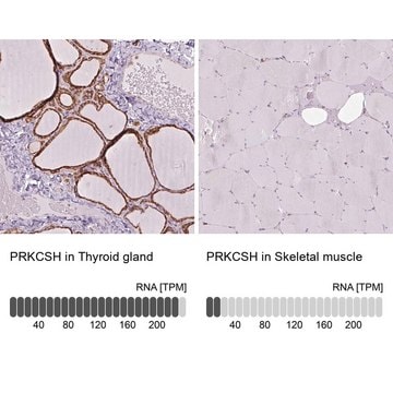 Anti-PRKCSH antibody produced in rabbit Prestige Antibodies&#174; Powered by Atlas Antibodies, affinity isolated antibody, buffered aqueous glycerol solution