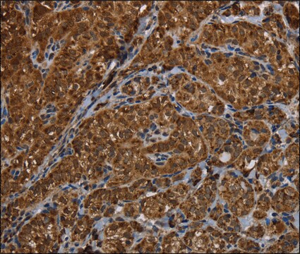 Anti-HSD17B13 antibody produced in rabbit affinity isolated antibody