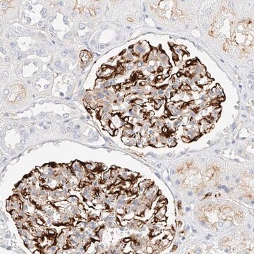 Anti-CDCP2 antibody produced in rabbit Prestige Antibodies&#174; Powered by Atlas Antibodies, affinity isolated antibody, buffered aqueous glycerol solution