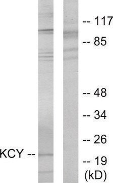 Anti-KCY antibody produced in rabbit affinity isolated antibody