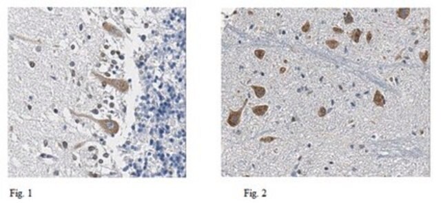 Anti-GLUT9 Antibody from rabbit, purified by affinity chromatography