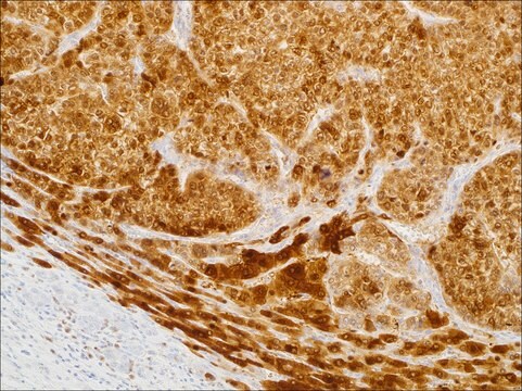 Arginase-1 (EP261) Rabbit Monoclonal Primary Antibody