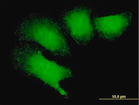 Anti-MAGEB18 antibody produced in mouse purified immunoglobulin, buffered aqueous solution