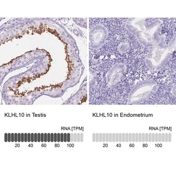 Anti-KLHL10 antibody produced in rabbit Prestige Antibodies&#174; Powered by Atlas Antibodies, affinity isolated antibody, buffered aqueous glycerol solution