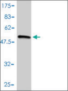 Monoclonal Anti-COL2A1 antibody produced in mouse clone 3H1-F9, purified immunoglobulin, buffered aqueous solution