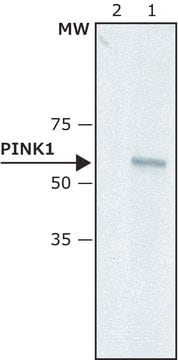 Anti-PINK1 (N-terminal) antibody produced in rabbit ~1.5&#160;mg/mL, affinity isolated antibody, buffered aqueous solution