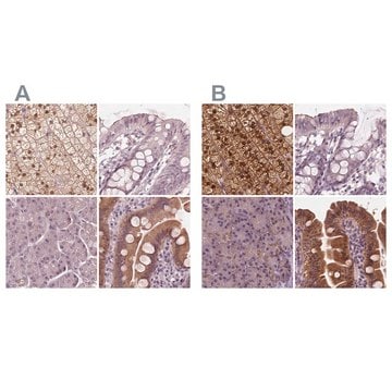 Anti-SAT2 antibody produced in rabbit Prestige Antibodies&#174; Powered by Atlas Antibodies, affinity isolated antibody, buffered aqueous glycerol solution