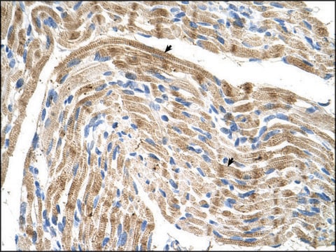 Anti-FADS1 antibody produced in rabbit IgG fraction of antiserum