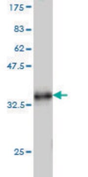 ANTI-TFF1 antibody produced in mouse clone M1, purified immunoglobulin, buffered aqueous solution