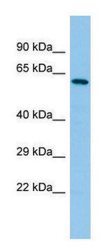 Anti-YTHDF2 (C-terminal) antibody produced in rabbit affinity isolated antibody