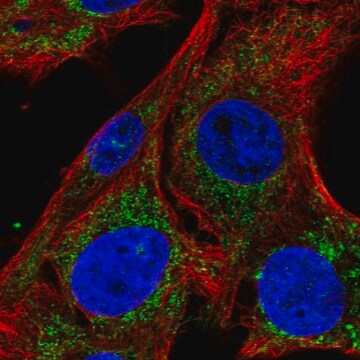 Anti-SLC25A34 antibody produced in rabbit Prestige Antibodies&#174; Powered by Atlas Antibodies, affinity isolated antibody