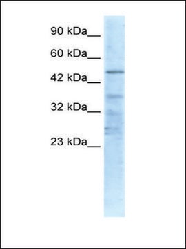 Anti-CHRNA1 (AB1) antibody produced in rabbit affinity isolated antibody