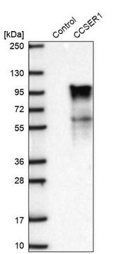 Anti-CCSER1 antibody produced in rabbit Prestige Antibodies&#174; Powered by Atlas Antibodies, affinity isolated antibody, buffered aqueous glycerol solution