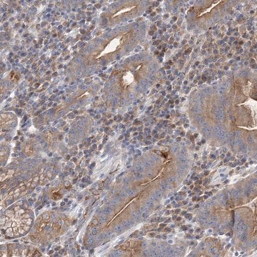 Anti-ATP11B antibody produced in rabbit Prestige Antibodies&#174; Powered by Atlas Antibodies, affinity isolated antibody, buffered aqueous glycerol solution