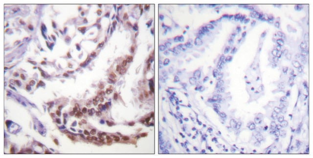 Anti-Histone H3 (Acetyl-Lys9) antibody produced in rabbit affinity isolated antibody