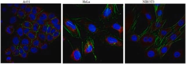 Anti-KIF3A Antibody from rabbit, purified by affinity chromatography