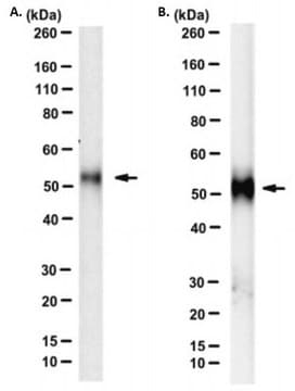 Anti-HYAL1 Antibody, clone 1D10