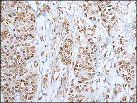 Anti-ZNF302 affinity isolated antibody