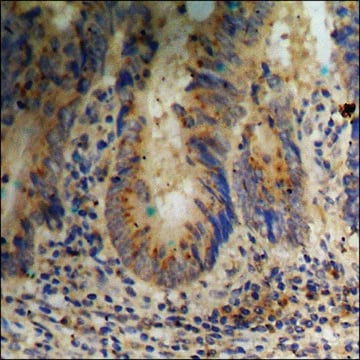 Anti-phospho-ERK8 (pThr175+Tyr177) antibody produced in rabbit affinity isolated antibody