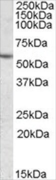 Anti-CES1 antibody produced in goat affinity isolated antibody, buffered aqueous solution