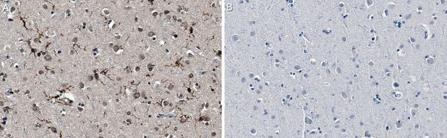 Anti-P2RY12 Antibody, clone 10B5.3.27