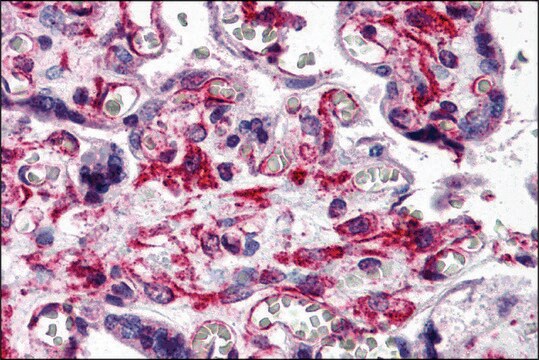 Anti-RUSC2 antibody produced in rabbit affinity isolated antibody