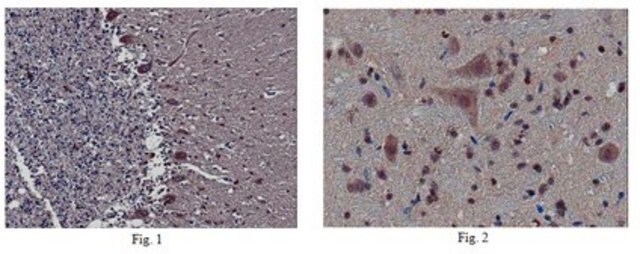 Anti-DBN1 Antibody from rabbit, purified by affinity chromatography