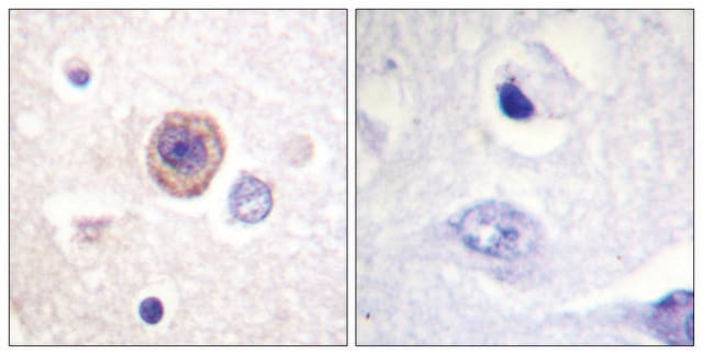 Anti-Tryptophan Hydroxylase, N-Terminal antibody produced in rabbit affinity isolated antibody