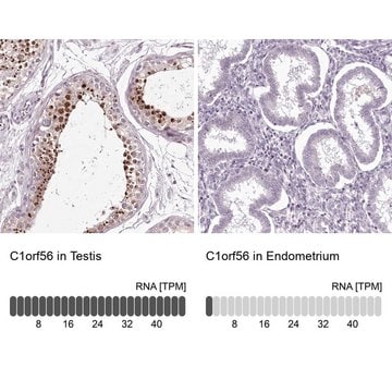 Anti-C1orf56 antibody produced in rabbit Prestige Antibodies&#174; Powered by Atlas Antibodies, affinity isolated antibody, buffered aqueous glycerol solution