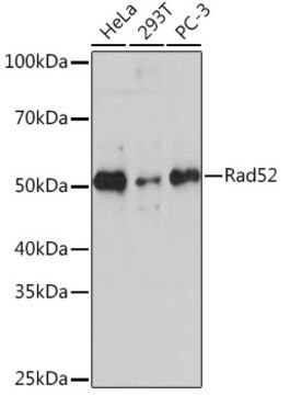 Anti-Rad52 Antibody, clone 7H5K0, Rabbit Monoclonal