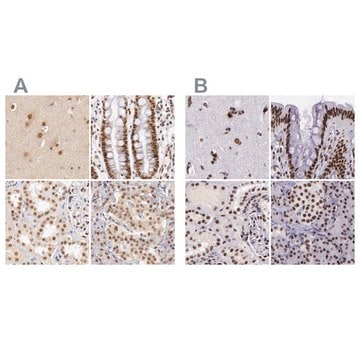 Anti-GPKOW antibody produced in rabbit Ab1, Prestige Antibodies&#174; Powered by Atlas Antibodies, affinity isolated antibody, buffered aqueous glycerol solution