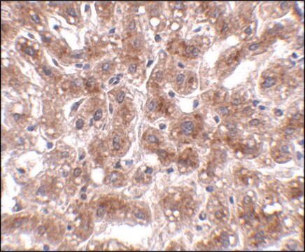 Anti-CUEDC1 antibody produced in rabbit affinity isolated antibody, buffered aqueous solution