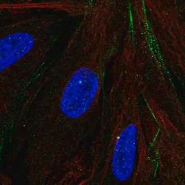 Anti-MTMR9 antibody produced in rabbit Prestige Antibodies&#174; Powered by Atlas Antibodies, affinity isolated antibody