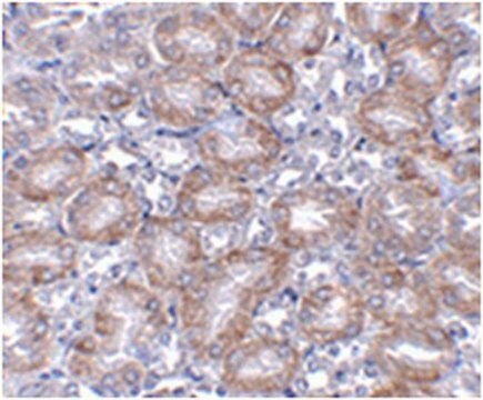 Anti-MTCH2 Antibody from rabbit, purified by affinity chromatography