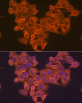 Anti-PIK3R4/VPS15 Antibody, clone 5J3U5, Rabbit Monoclonal