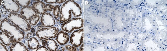 Anti-TFAM Antibody, clone 1C10 ZooMAb&#174; Rabbit Monoclonal recombinant, expressed in HEK 293 cells