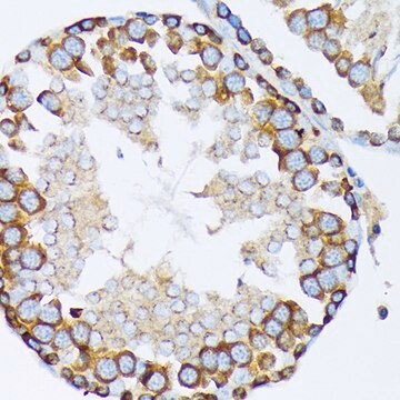 Anti-&#947;-Tubulin Antibody, clone 5R3N3, Rabbit Monoclonal