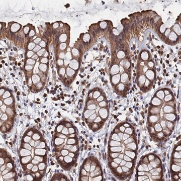 Anti-PIGN antibody produced in rabbit Prestige Antibodies&#174; Powered by Atlas Antibodies, affinity isolated antibody, buffered aqueous glycerol solution